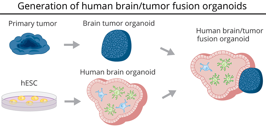 Generation of brain tumor fusion organoids