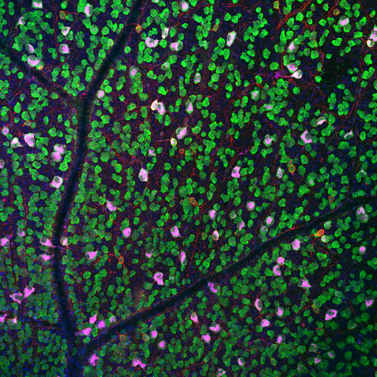 Protecting injured neurons from degeneration